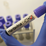 Riesgo de hantavirus y sarampión en Nueva York es muy bajo, según comisionado de Salud